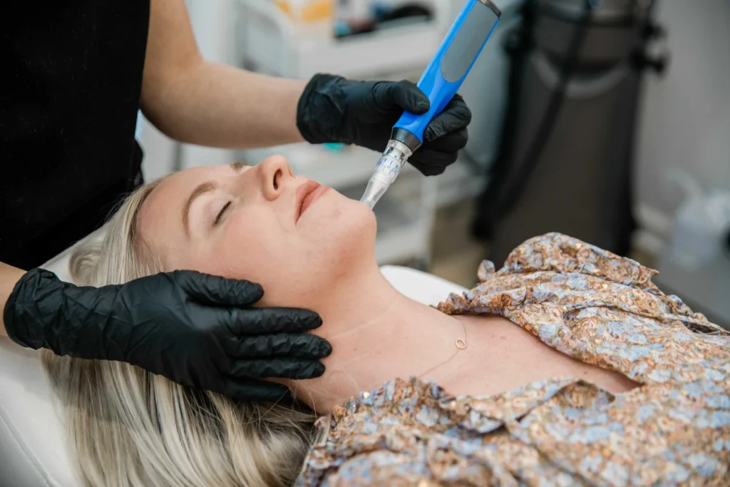 Microneedling with Skin pen | ARA Med Spa Inc | Beverly Hills CA