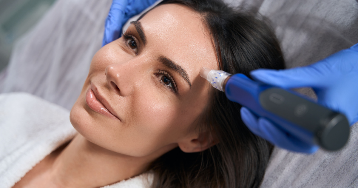 Skinpen Microneedling treatment on woman's forehead at a clinic in Beverly Hills, CA
